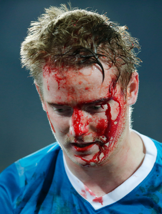 Illustration for article titled Zenit Player's Face Was A River Of Blood After Getting Kneed In Head